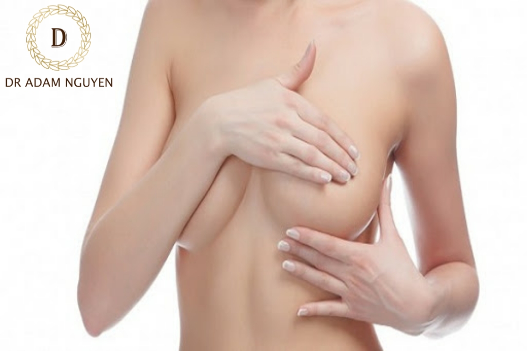 Nâng cấp vòng 1 chảy xệ