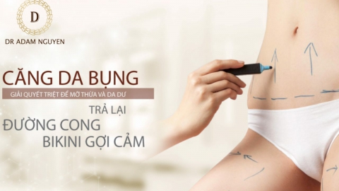 3 Điều quan trọng cần biết về căng da bụng